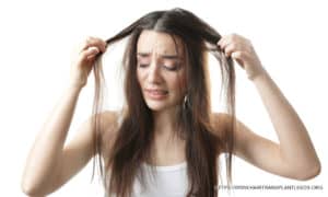 Hair-Loss-for-Women-Leeds-300x180